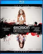 Excision